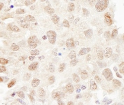 Cullin 3 Antibody, Novus Biologicals 0.1mL; Unlabeled:Antibodies, Polyclonal